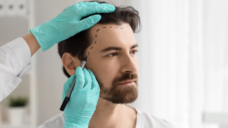 Best Hair Loss Specialist Near Laurel, Maryland